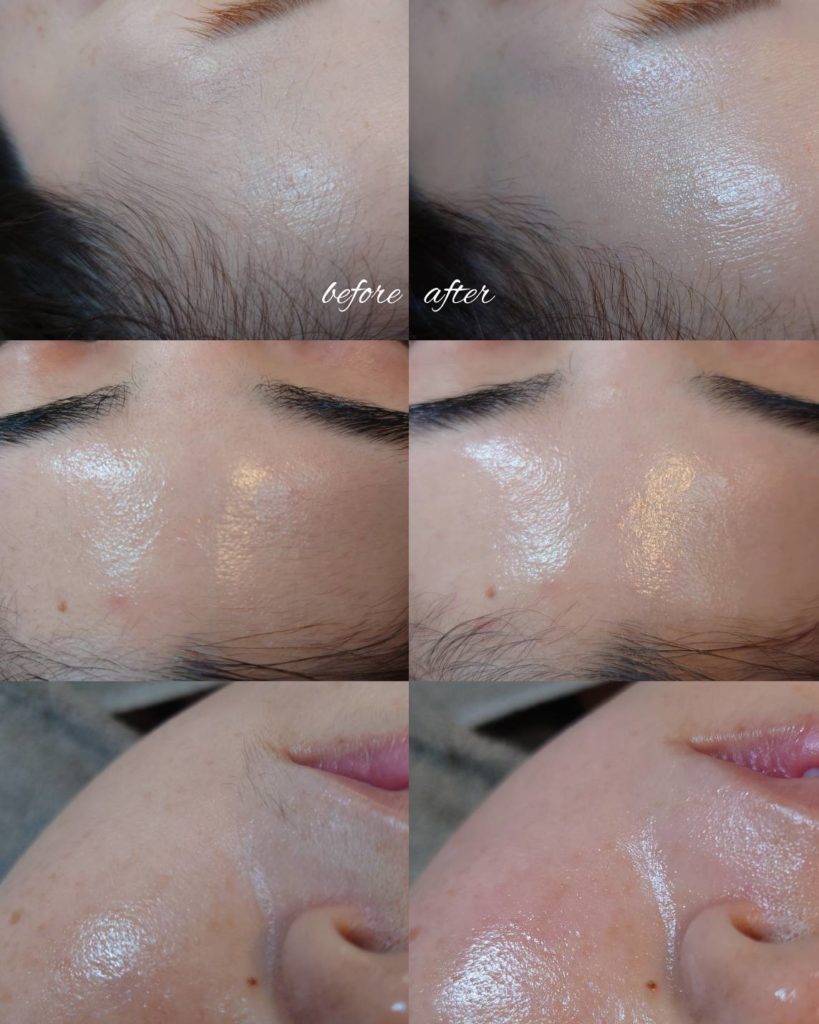 フェイシャルワックストリートメントのビフォーアフター