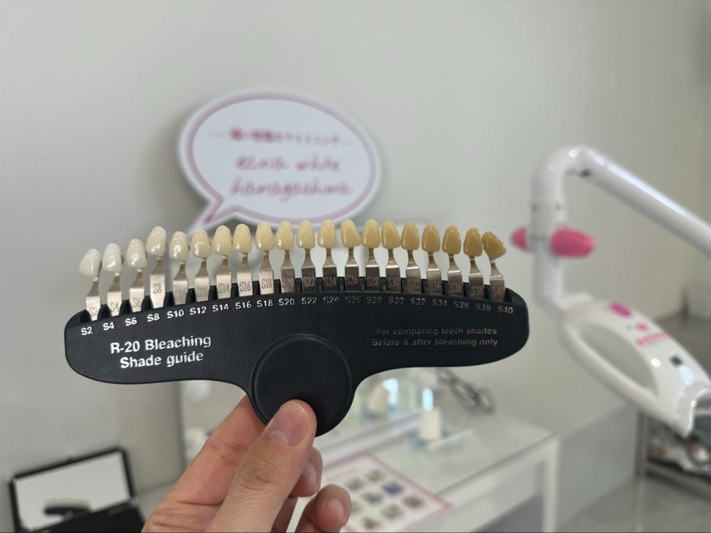 シェードガイド