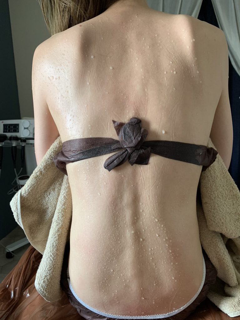 施術後は、滝のような汗をかいてスッキリ！