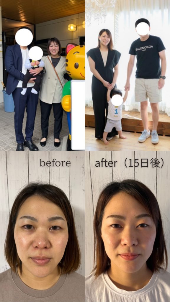 15日間若返りコース