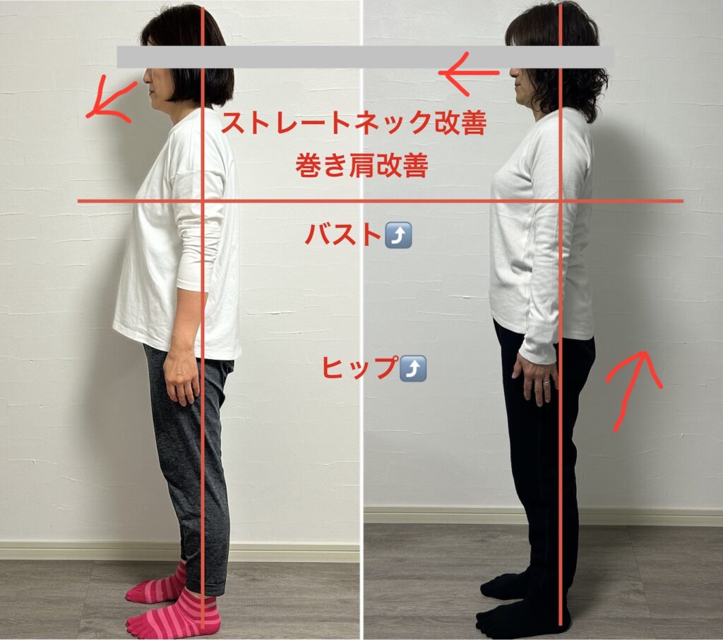 ビフォーアフター