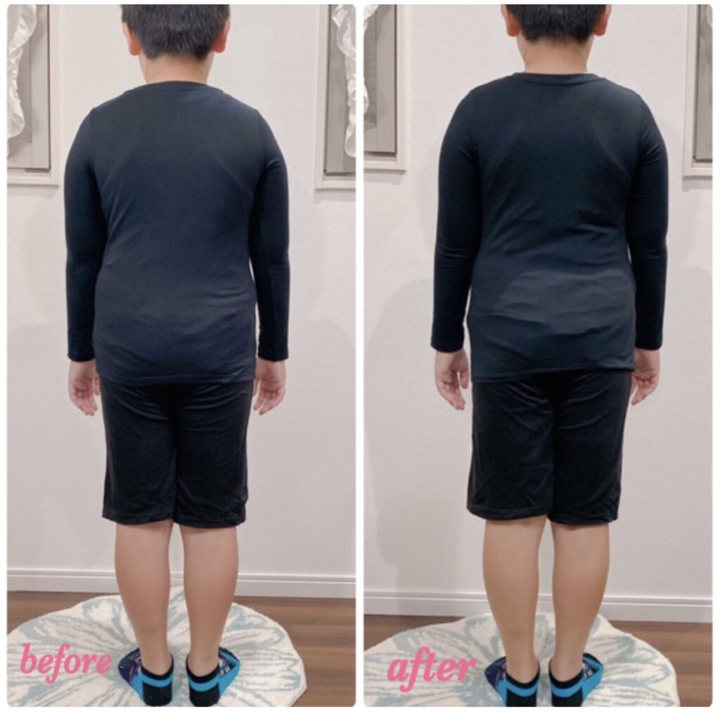 ビフォーアフター