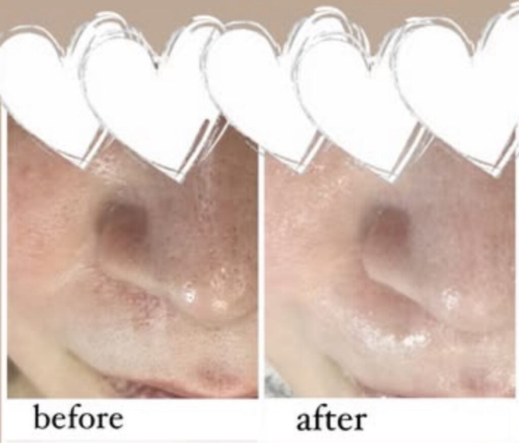 角質ケアピーリング