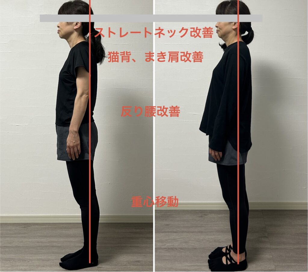 ビフォーアフター